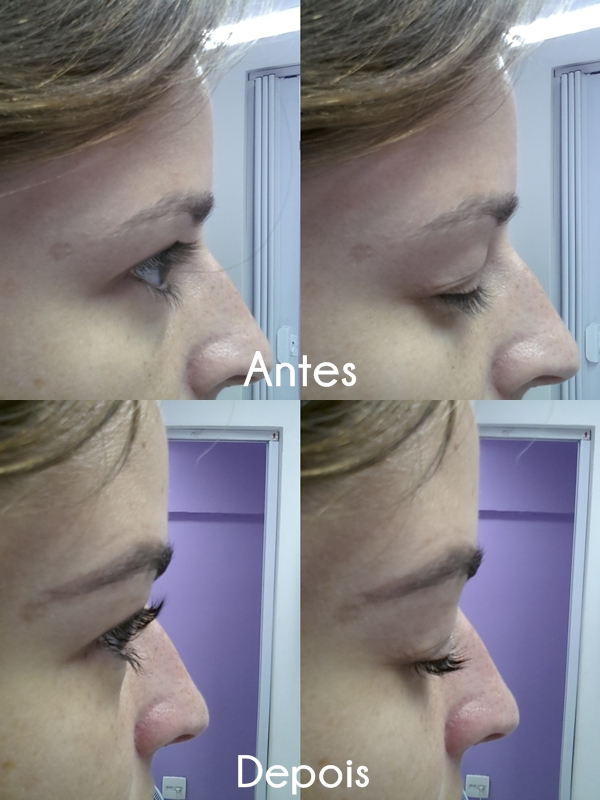 antes-e-depois-do-permanente-e-coloracao-dos-cilios